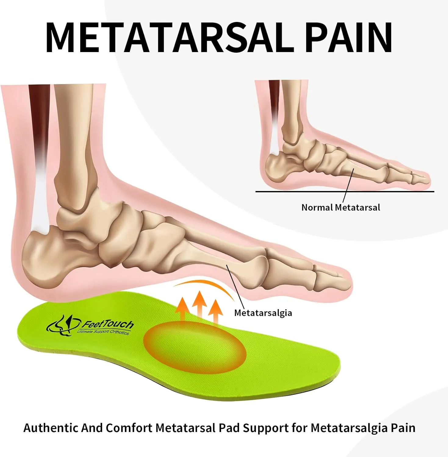 Strong Arch Support Orthotics for Metatarsalgia Morton's Neuroma,Ball of Foot Pain Relief Inserts Carbon Fiber PU Insoles Plantar Fasciitis Metatarsal Pad Support with Poron Heel Cushion