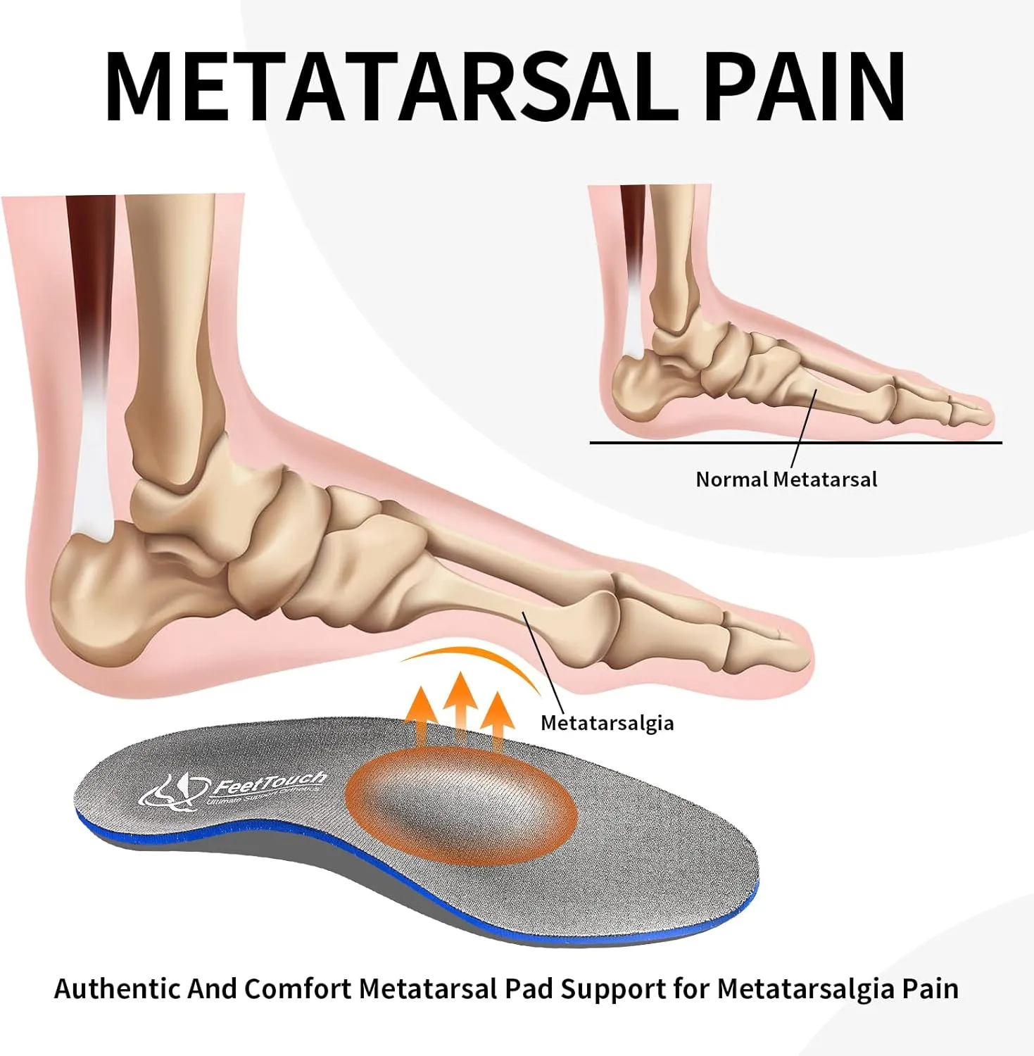 Strong Arch Support Orthotics for Metatarsalgia Morton's Neuroma,Ball of Foot Pain Relief Inserts Plantar Fasciitis Flat Feet with Poron Heel Cushion Grey